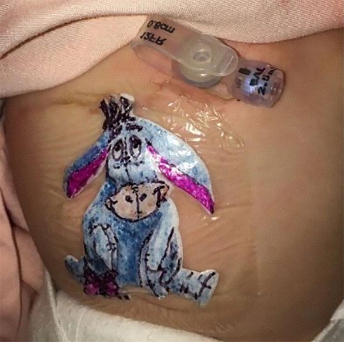Dr.-Robert-Parry-drew-Eeyore-on-a-childs-post-op-dressing