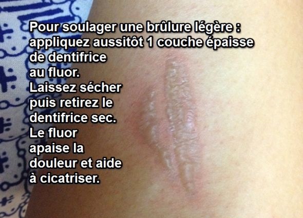 dentifrice-astuce-17