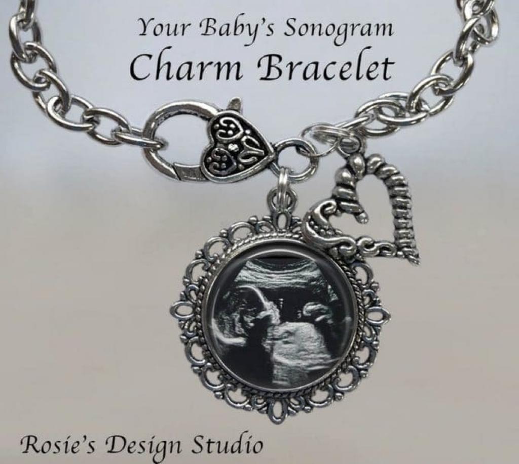 souvenir-échographie-grossesse-2