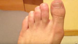 astuce-Vicks-VapoRub-91